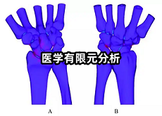 醫(yī)學(xué)有限元分析.png